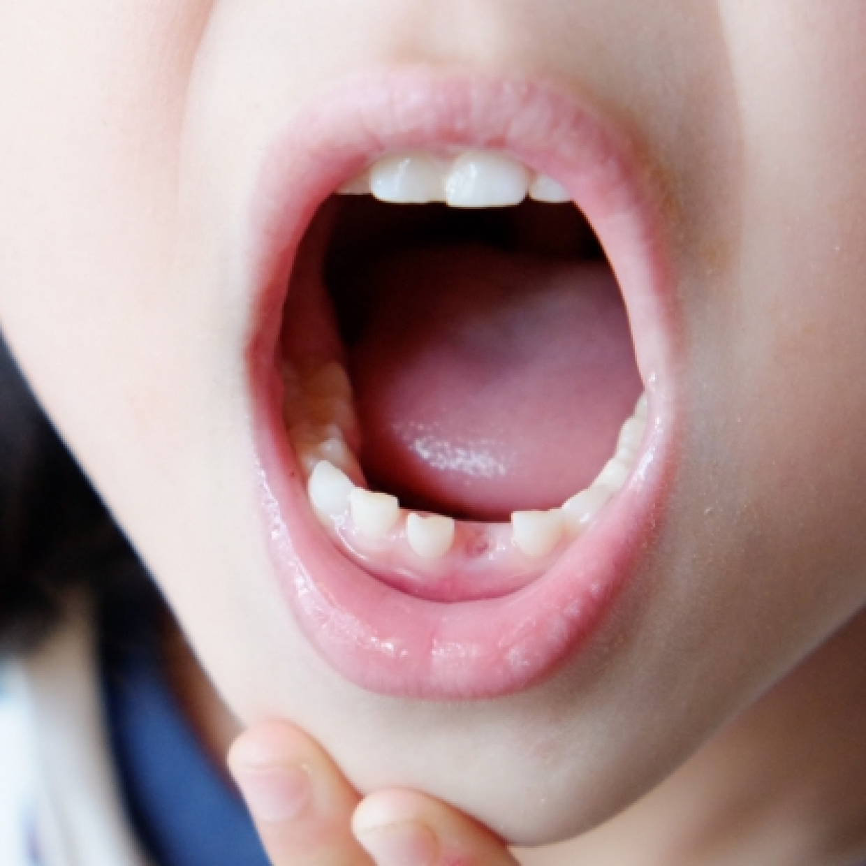  【歯科医が教える】生え変わり期（混合歯列期）は虫歯になりやすい！歯磨きと仕上げ磨きのポイントは？ 