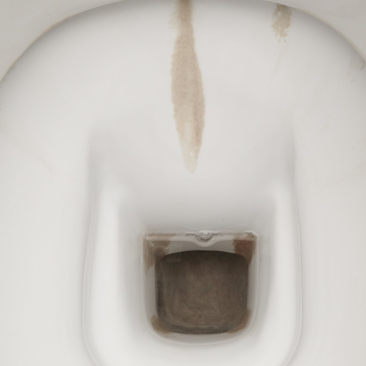  そのまま放置はNG！普通にこすっても落ちない「トイレの黒ずみ」の“3つの原因” 