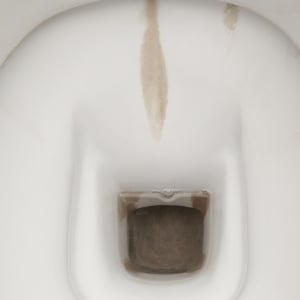 そのまま放置はNG！普通にこすっても落ちない「トイレの黒ずみ」の“3つの原因”