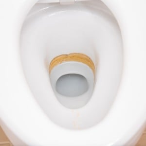 ゴシゴシ不要！“トイレの黄ばみ”をスルッと落とすトイレ掃除の相棒「ラク過ぎて手放せない」