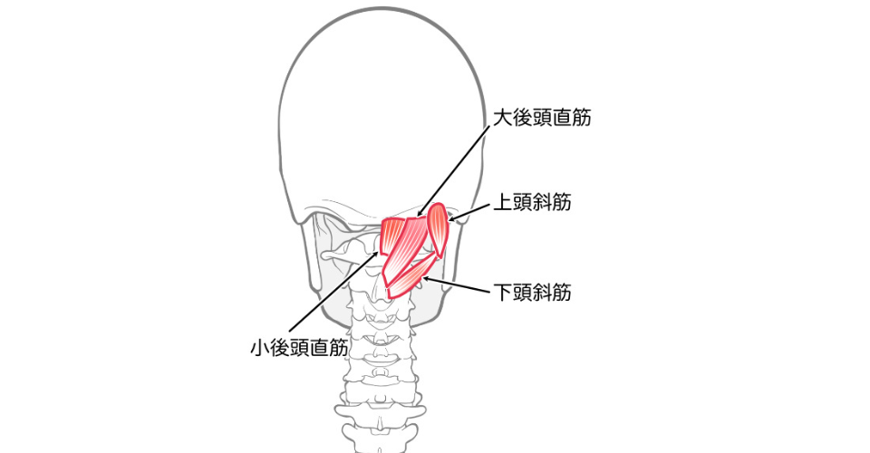 図解