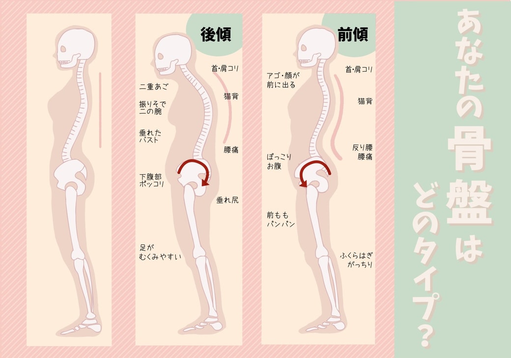 骨盤のタイプ