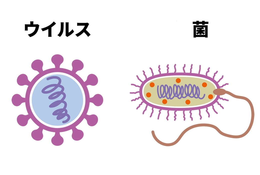 違い