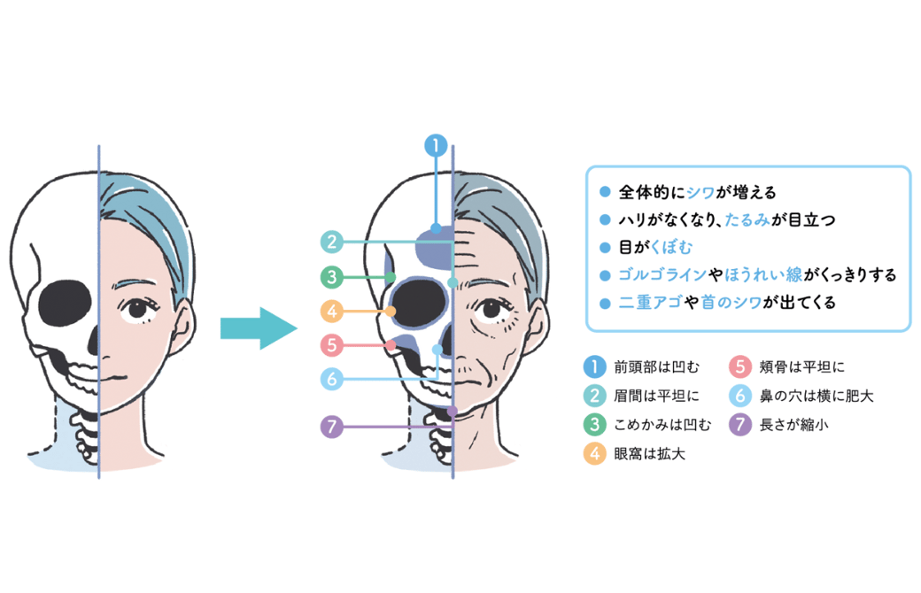 骨密度と顔の変化の関係