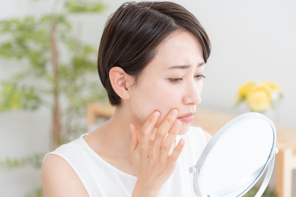 肌荒れを気にする女性