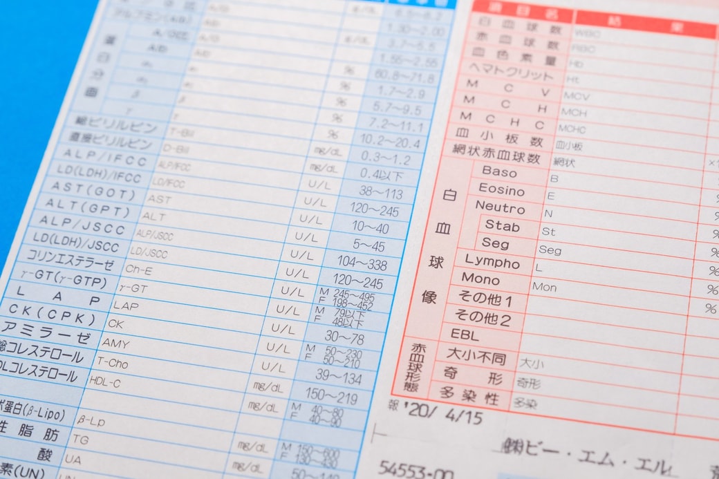 血液検査イメージ