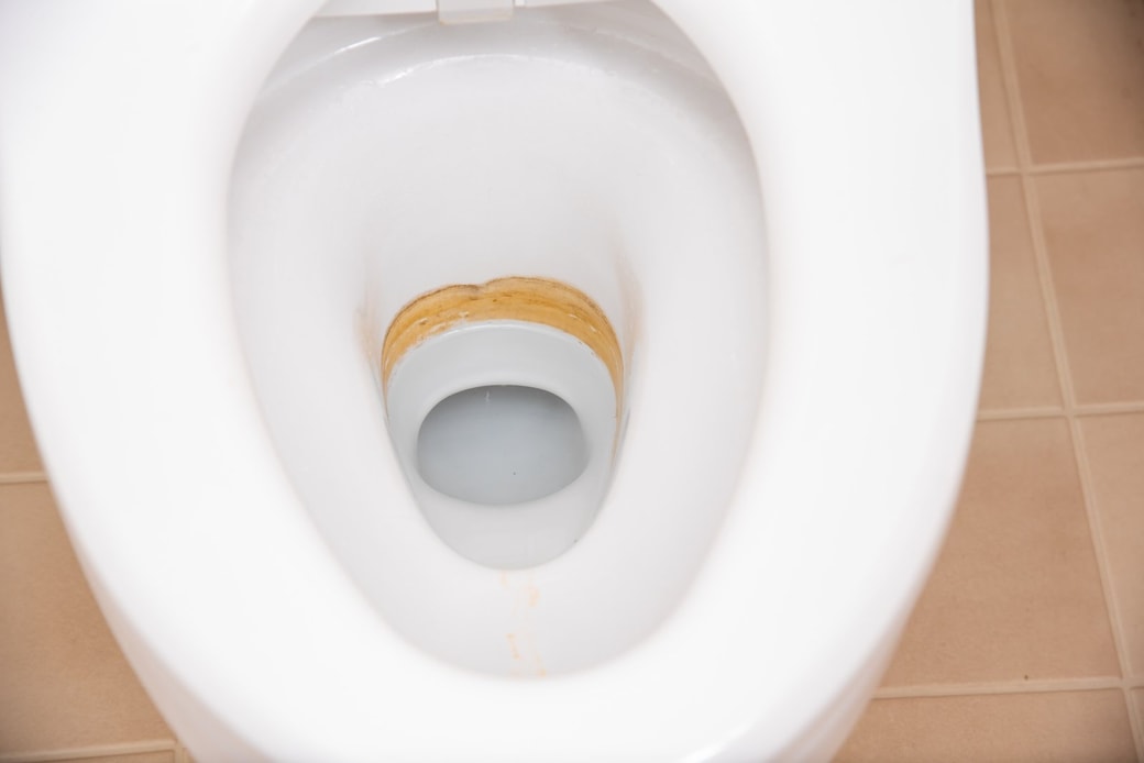 便器にこびりついた黄ばみ