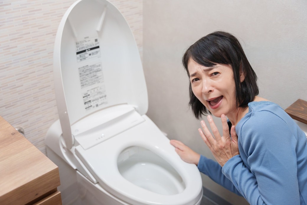 便器の汚れ