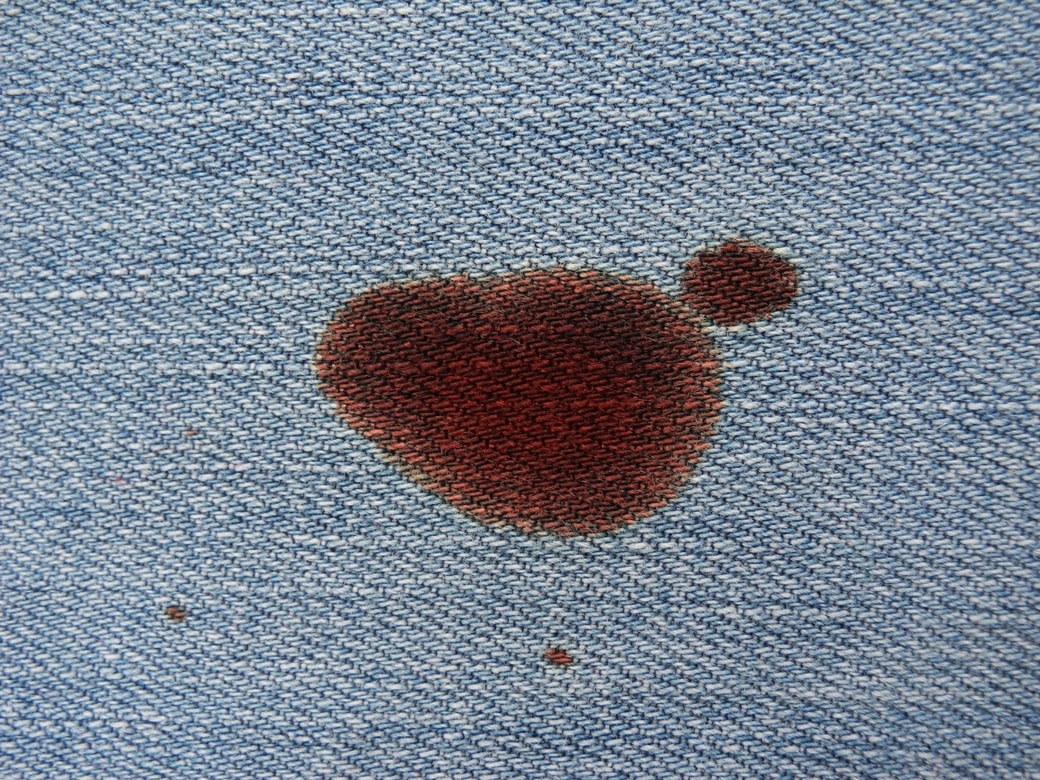 中性洗剤では落ちにくい③血液が染み込んだ汚れ