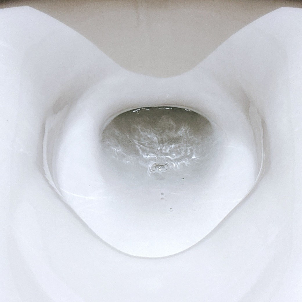 掃除後の便器の水たまり部