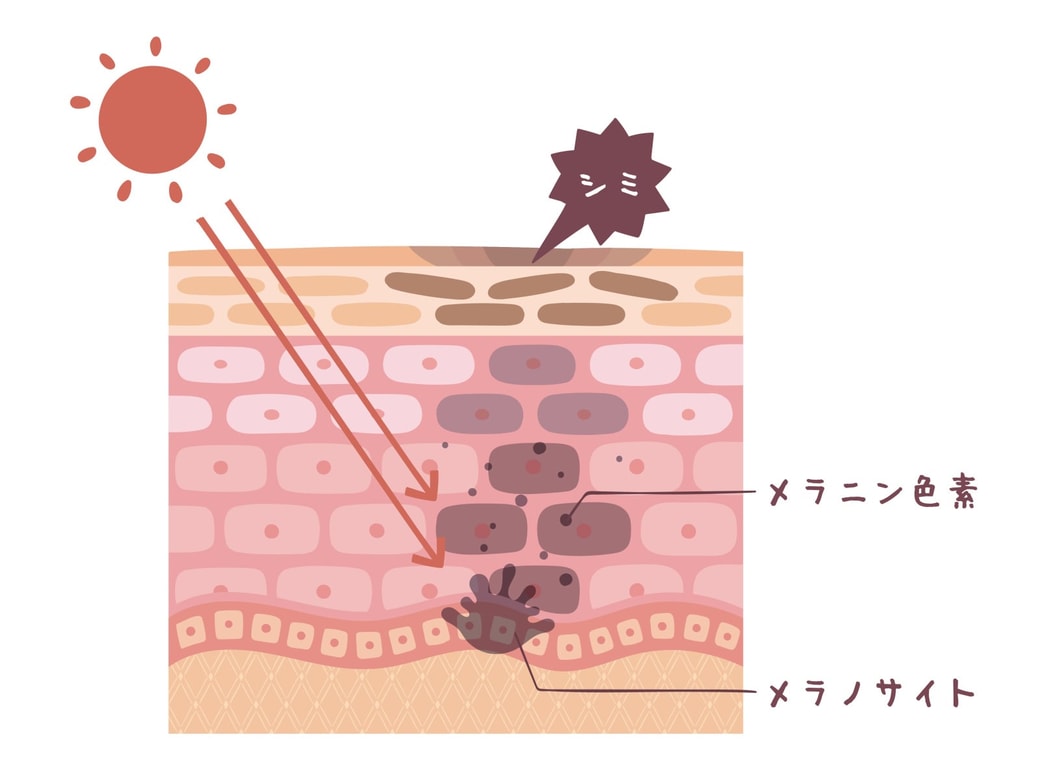紫外線の肌への影響