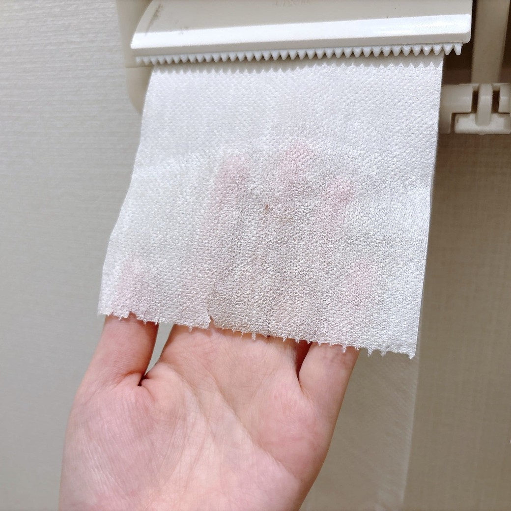 ずれたミシン目は無理に引っ張らずに解決